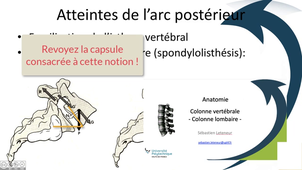 Atteintes de l'arc postérieur