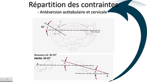 Articulation coxo-fémorale - contraintes