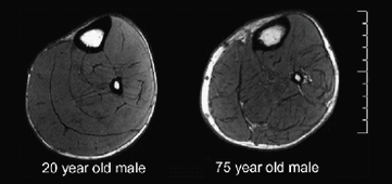 L3P_SHN_L1_Physio_Cours#12_Adaptations-neuromuscu.mp4