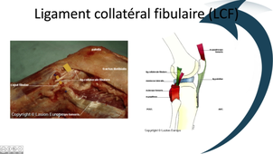 Ligaments collatéraux du genou